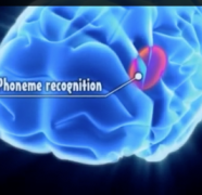 Good Visual Demonstration of Dyslexia and the Brain